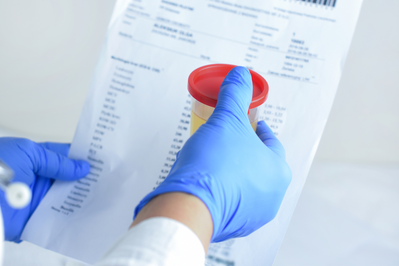doctor holding urine sample and test results