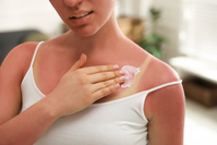 woman applying lotion to sunburned skin